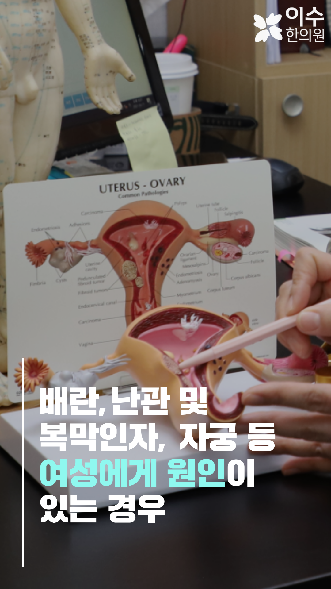 이수한의원 건강 칼럼 이미지